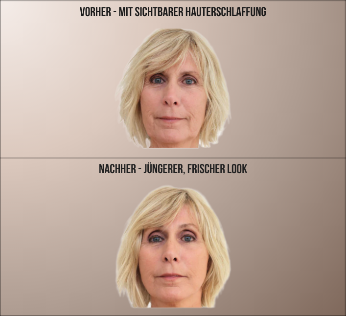 GlowTape™ – Straffes V-Shape in Sekunden