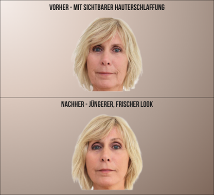 GlowTape™ – Straffes V-Shape in Sekunden